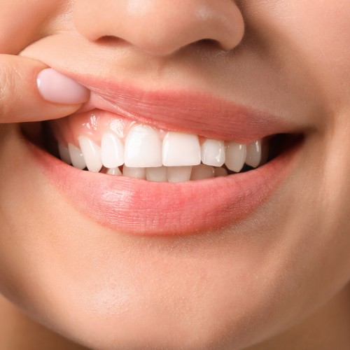Smiling woman with healthy teeth, representing the positive results of holistic dental care and ozone therapy from The Dental Shaman.
